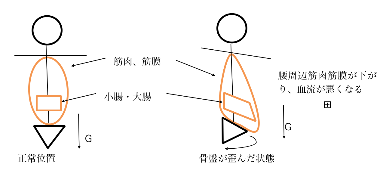 なぜガンコな腰痛が 内臓を正常な位置 へ戻すと スッキリと痛みが解消するのか 香川県高松市 観光町皆川整体院 香川県高松市 観光町皆川整体院